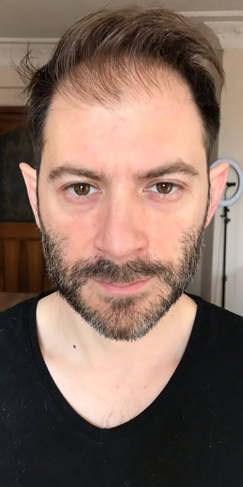 Before Image Before Image