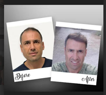 לואיס, ספרד